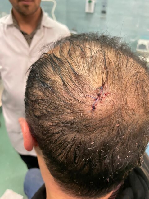 چاقوکشی روی رییس هیات کشتی مازندران در سالن مسابقات مشهد + عکس چاقوکشی روی رییس هیات کشتی مازندران در سالن مسابقات مشهد + عکس