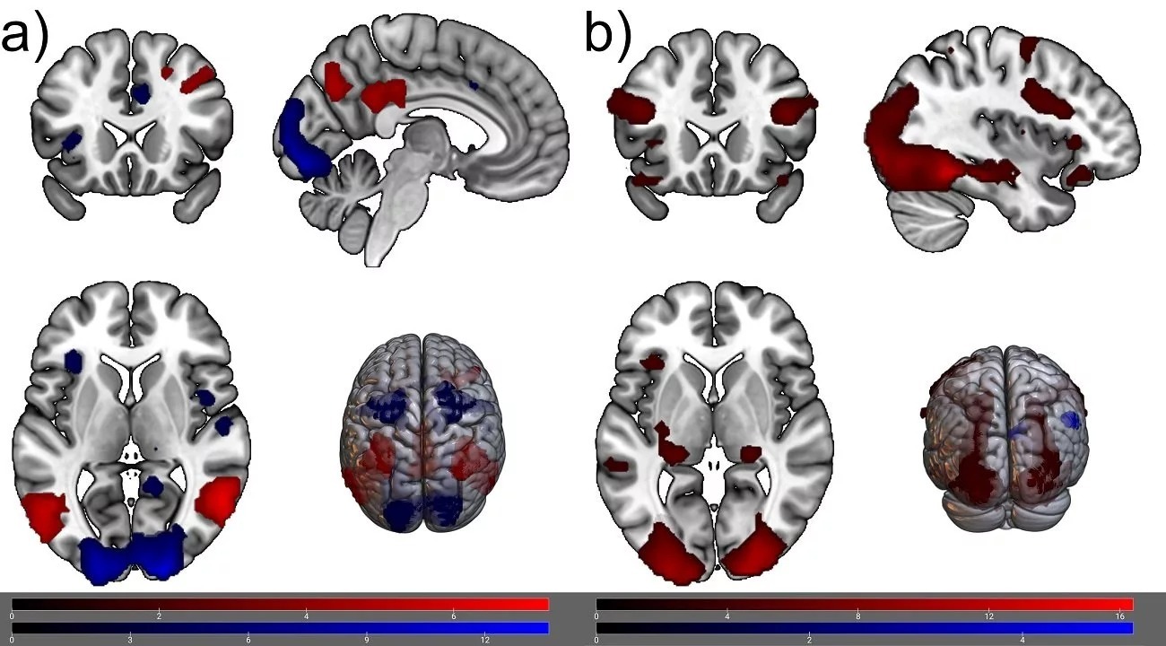 اگر سه روز از موبایل استفاده نکنیم چه تغییری در فعالیت مغزمان ایجاد میشود؟ اگر سه روز از موبایل استفاده نکنیم چه تغییری در فعالیت مغزمان ایجاد میشود؟