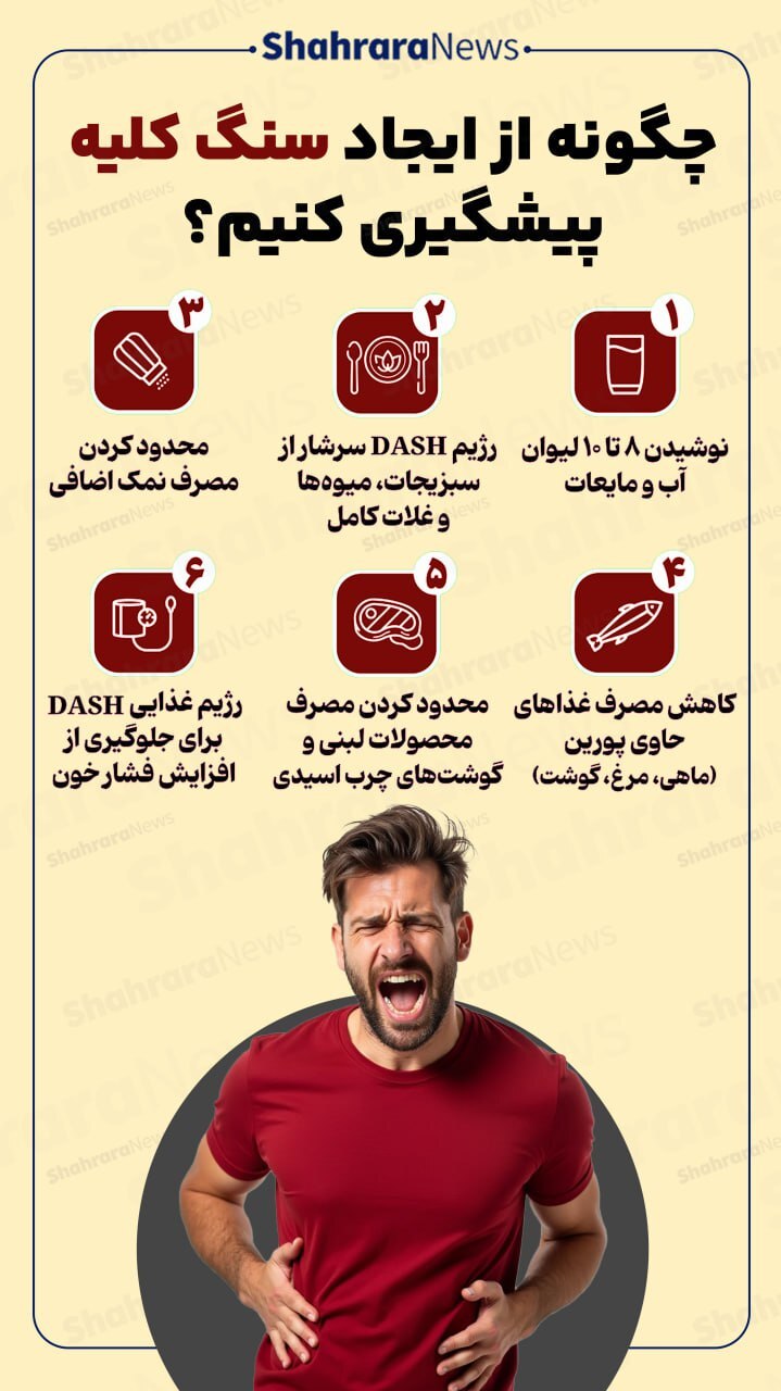 اینفوگرافی| چگونه از ایجاد سنگ کلیه پیشگیری کنیم؟