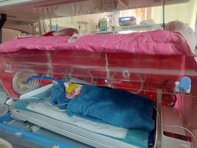 تولد نادر ۵ قلوها در تبریز + عکس تولد نادر ۵ قلوها در تبریز + عکس