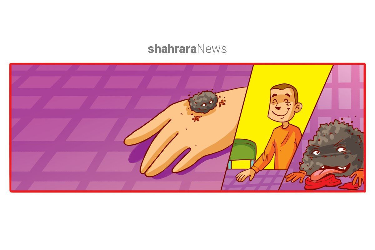 داستان کوتاه | میکروبی به نام چرکولک
