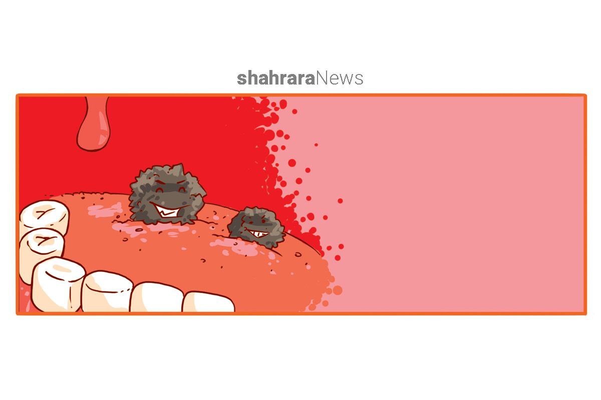 داستان کوتاه | میکروبی به نام چرکولک