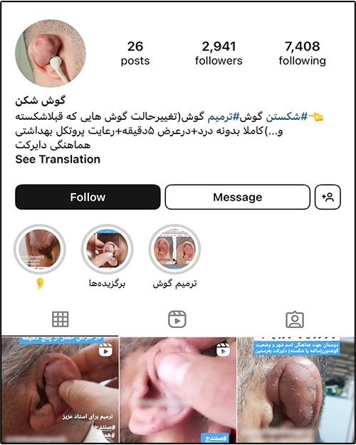 تب گوش شکسته! تب گوش شکسته!