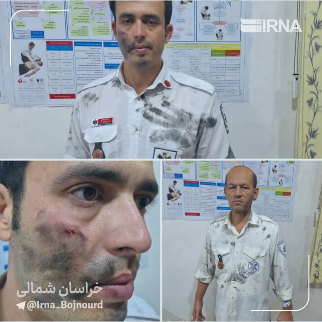 ضرب و شتم کارشناسان اورژانس در خراسانشمالی + عکس ضرب و شتم کارشناسان اورژانس در خراسانشمالی + عکس