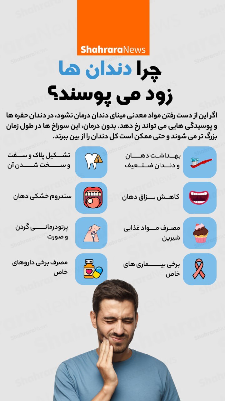 اینفوگرافی| چرا دندان‌ها زود می‌پوسند؟