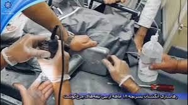 دست کودک ۱۸ ماهه اراکی در چرخ گوشت قطع شد(۲۶ شهریور ۱۴۰۳) دست کودک ۱۸ ماهه اراکی در چرخ گوشت قطع شد(۲۶ شهریور ۱۴۰۳)