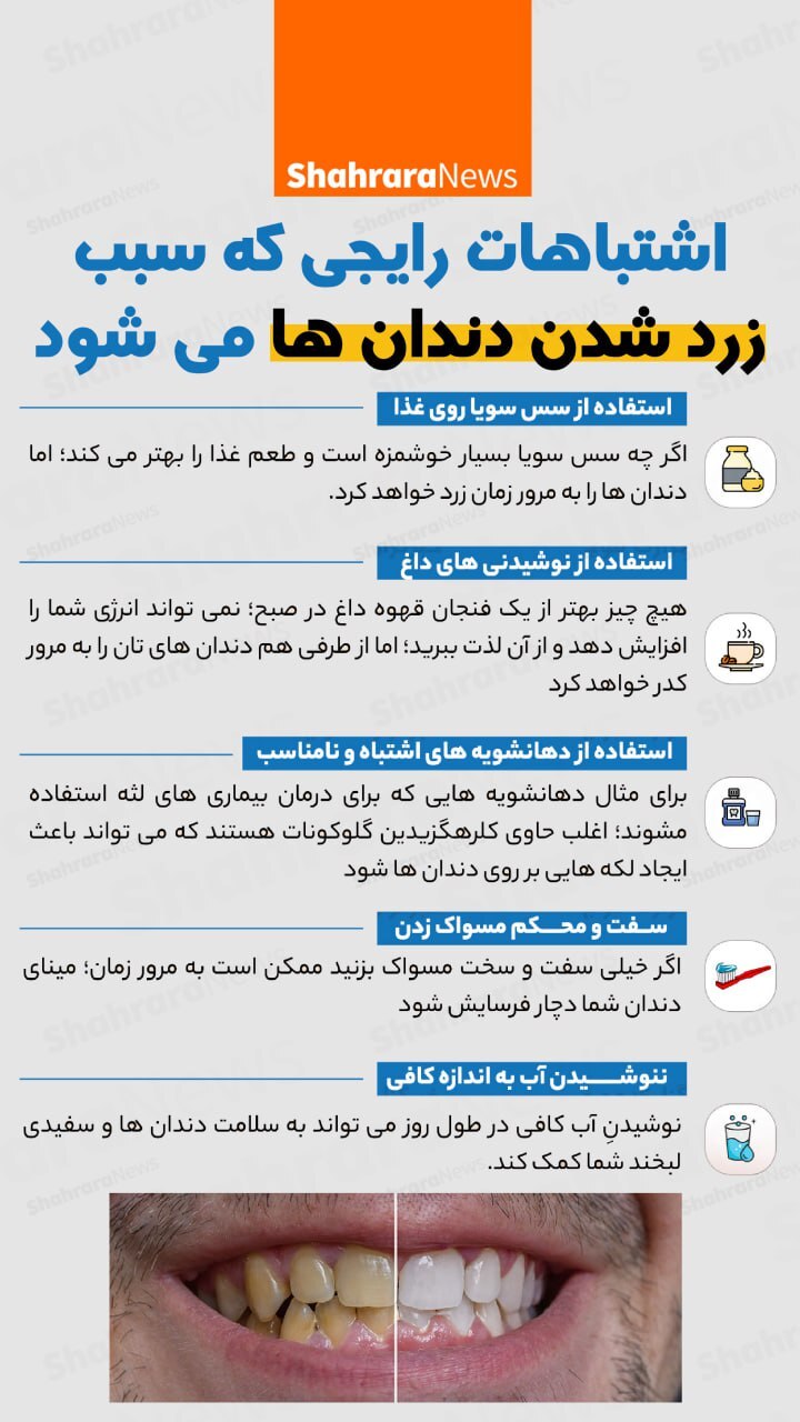 اینفوگرافی| اشتباهات رایجی که سبب زرد شدن دندان‌ها می‌شود