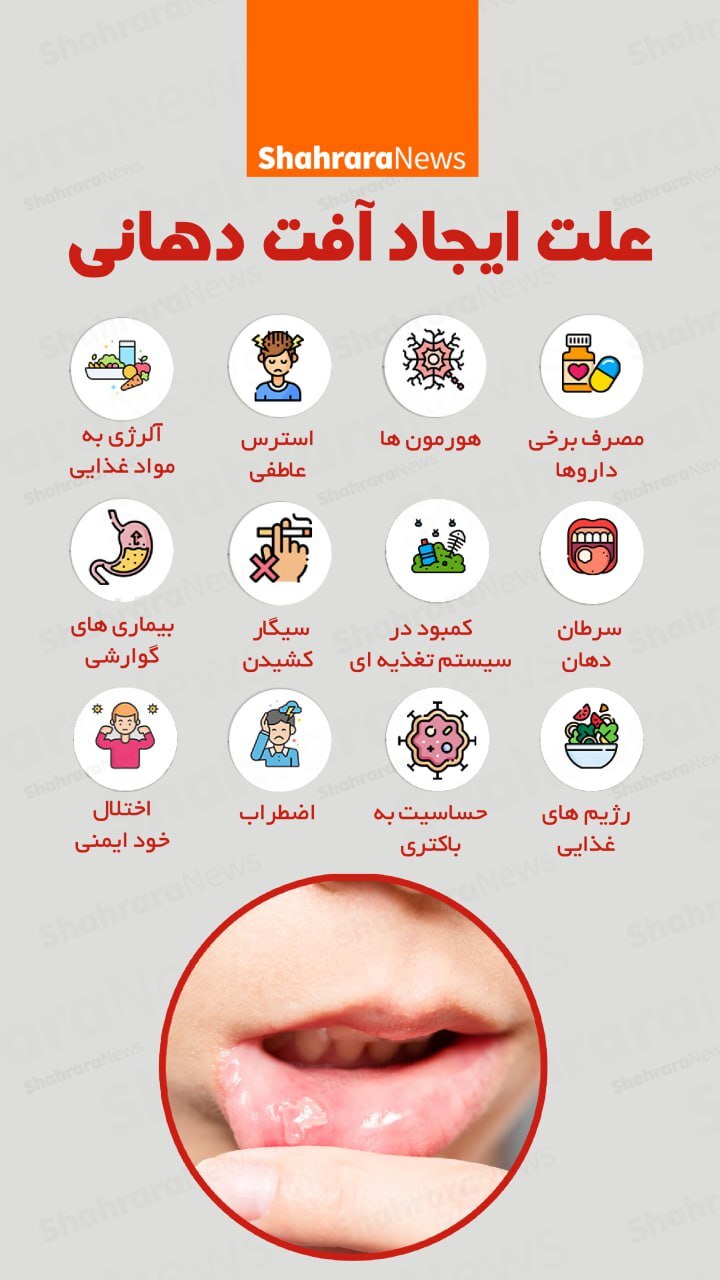 اینفوگرافی| علت ایجاد آفت دهانی