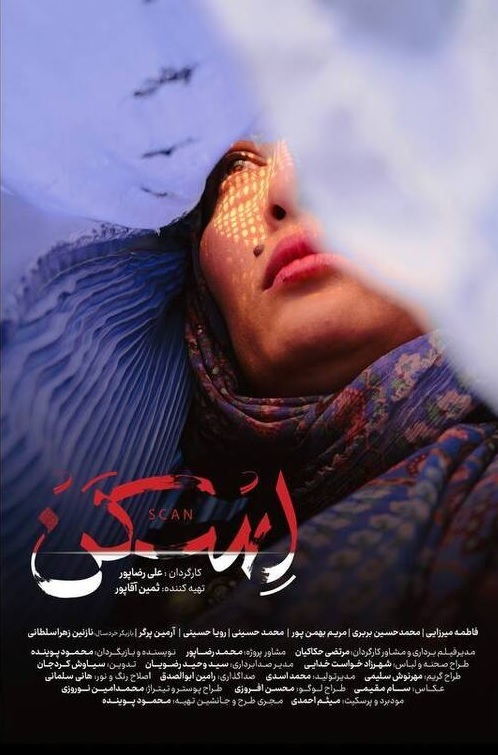 «اسکن» در راه کانادا «اسکن» در راه کانادا