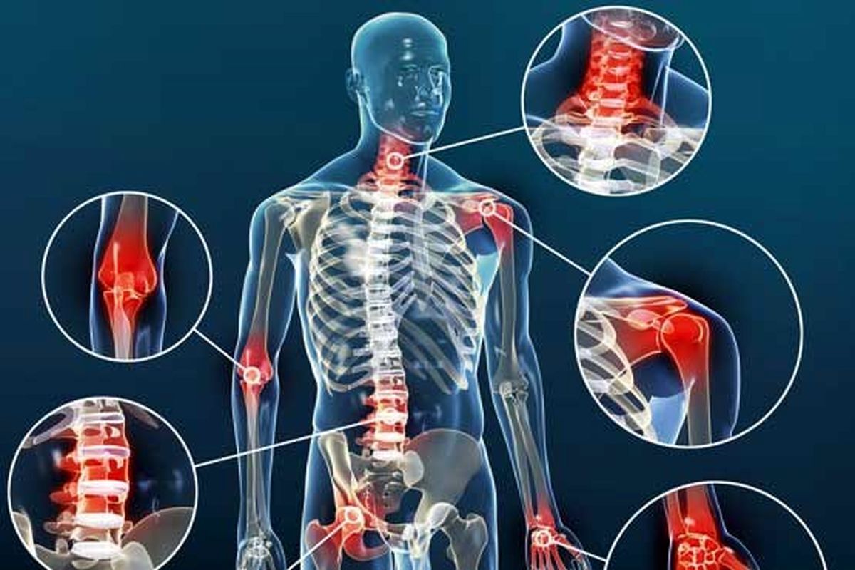 عوامل زمینه‌ساز تحلیل غضروف‌ها و بروز آرتروز چیست؟