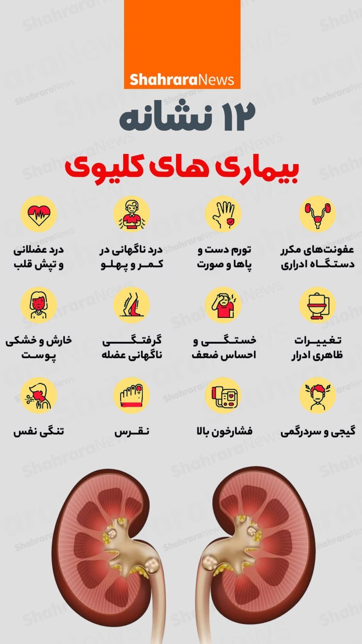 اینفوگرافی| ۱۲ نشانه بیماری‌های کلیوی