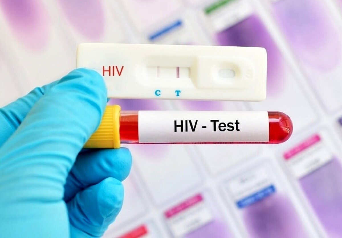 گزارش‌های میدانی و هشدار‌های متخصصین عفونی، حکایت از این واقعیت دارد که موارد ابتلا به HIV در کشور به سرعت در حال افزایش است.