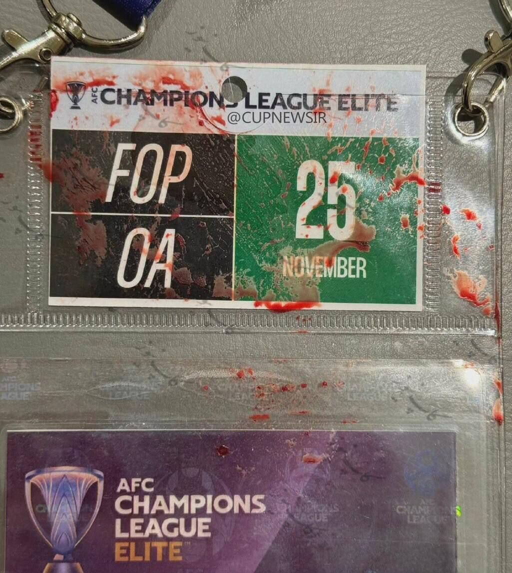 تصویر آیدیکارت خونین و دردناک امید عالیشاه در هنگام انتقال به بیمارستان تصویر آیدیکارت خونین و دردناک امید عالیشاه در هنگام انتقال به بیمارستان