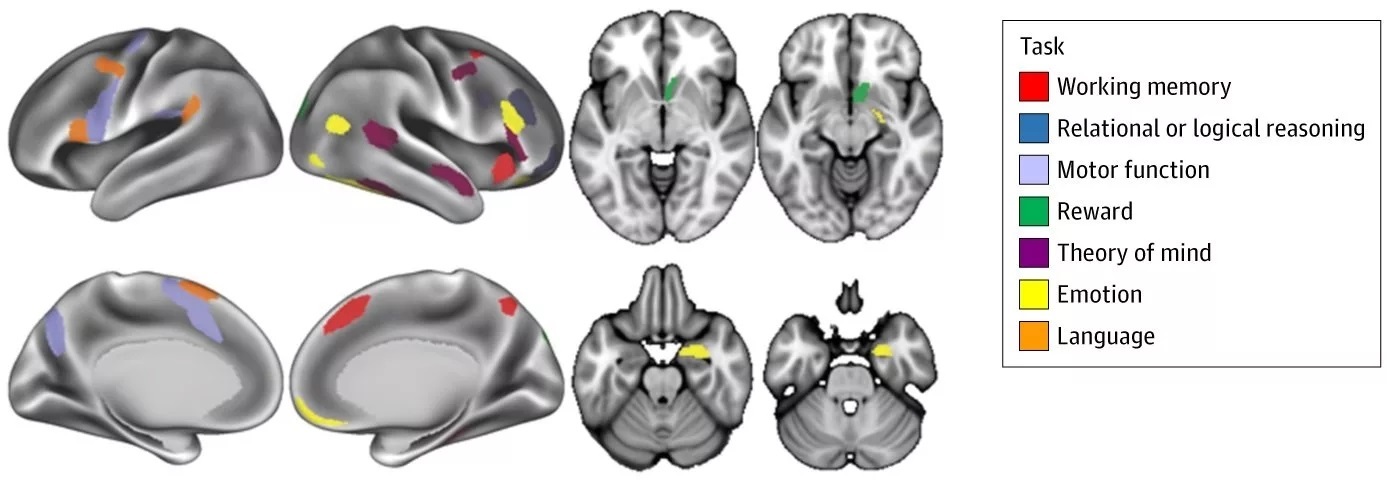 نتیجه پژوهشی جدید: مصرف ماریجوانا بر فعالیت مغز و حافظه تأثیر میگذارد نتیجه پژوهشی جدید: مصرف ماریجوانا بر فعالیت مغز و حافظه تأثیر میگذارد