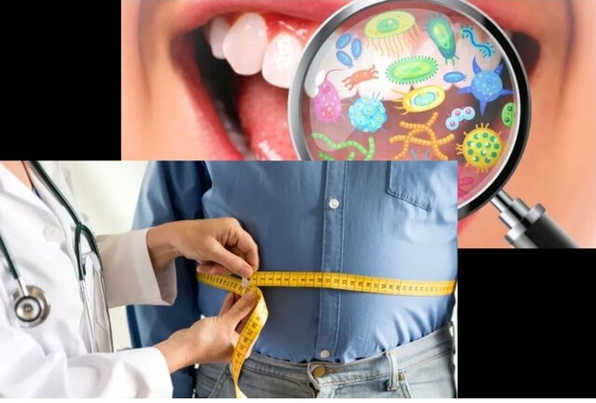 آیا میان میکروب&zwnj;های دهان و چاقی، ارتباطی وجود دارد؟