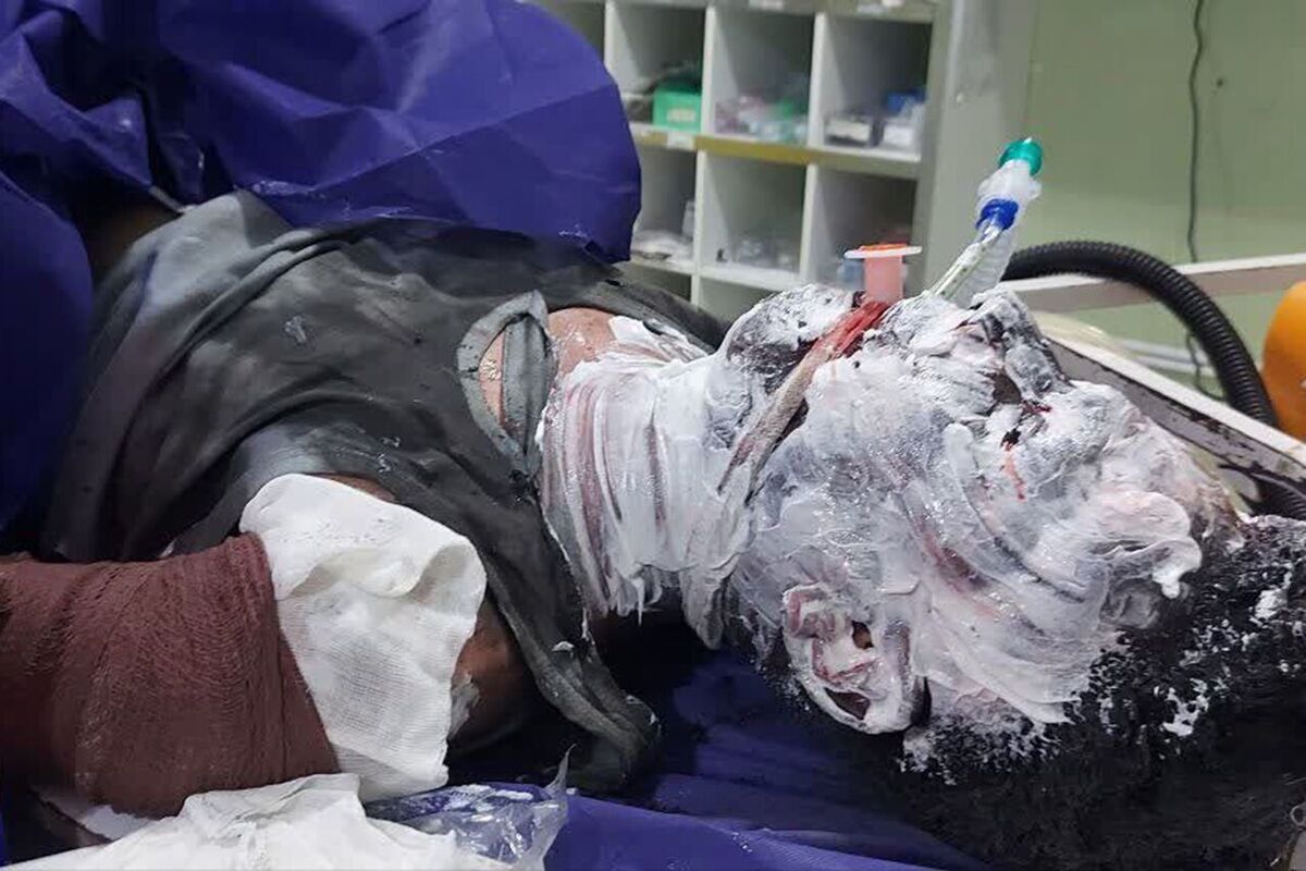 ۷۲ نفر براثر انفجار موادمحترقه مرتبط با چهارشنبه سوری مصدوم شدند (۲۶ اسفند ۱۴۰۴)