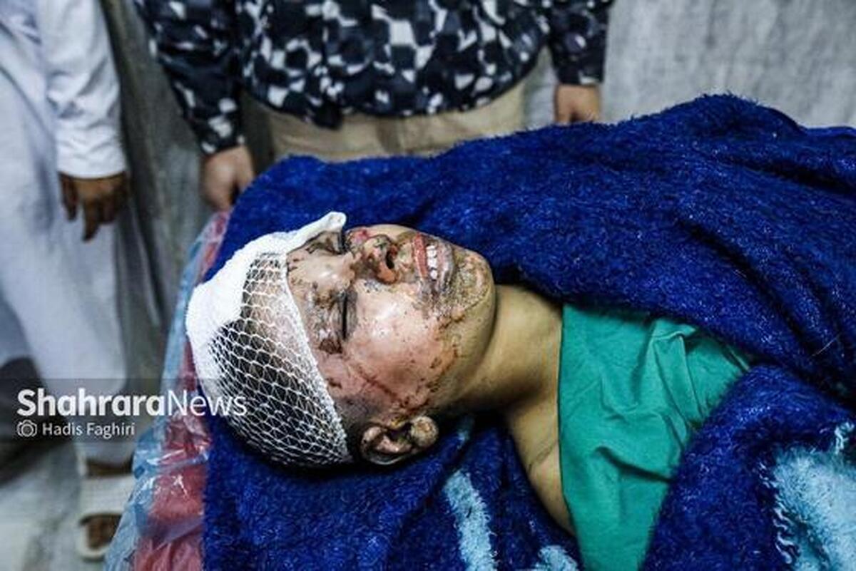 حوادث چهارشنبه&zwnj;سوری؛ ۳۳۱ مصدوم تاکنون| ۱۲ نفر قطع عضو شدند