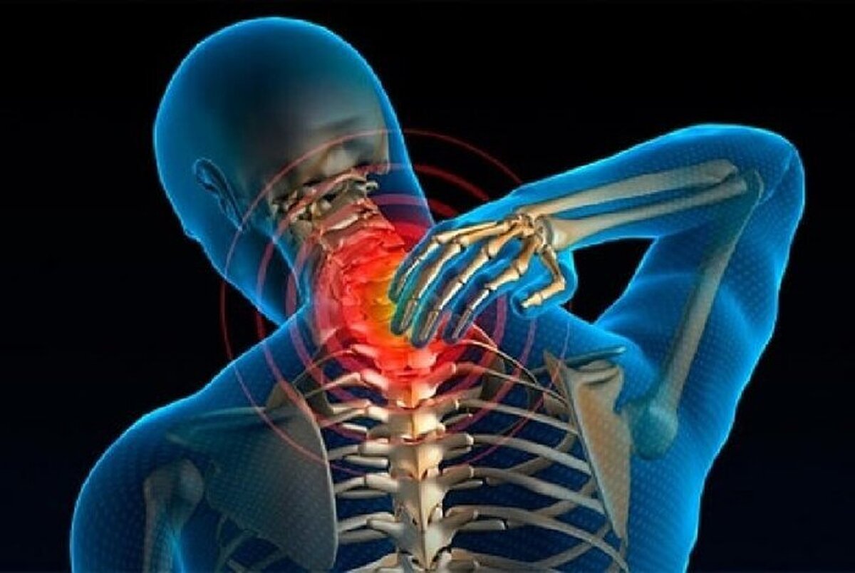علائم هشدار&zwnj;های اولیه آرتروز گردن کدام اند؟ | روش های نوین درمان آرتروز گردن