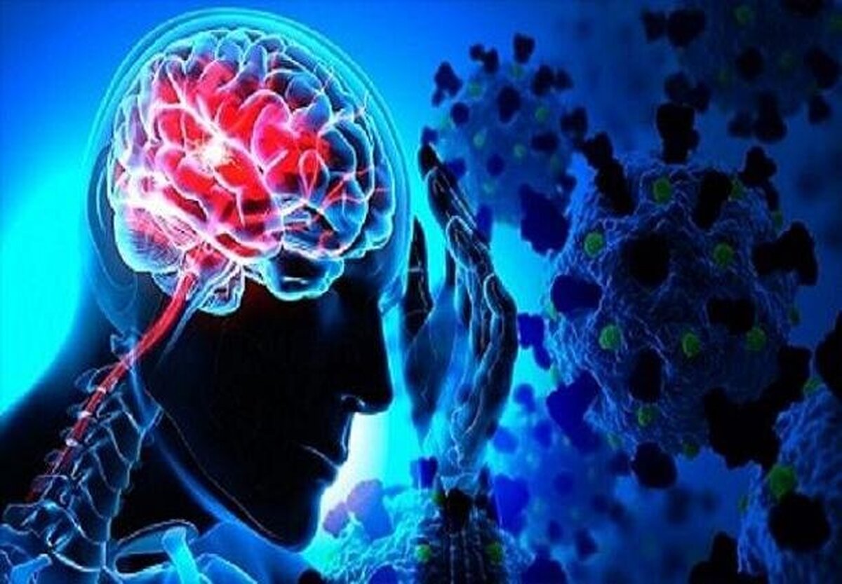 چگونه می‌توان خستگی ناشی از «ام‌اس» را مدیریت کرد؟