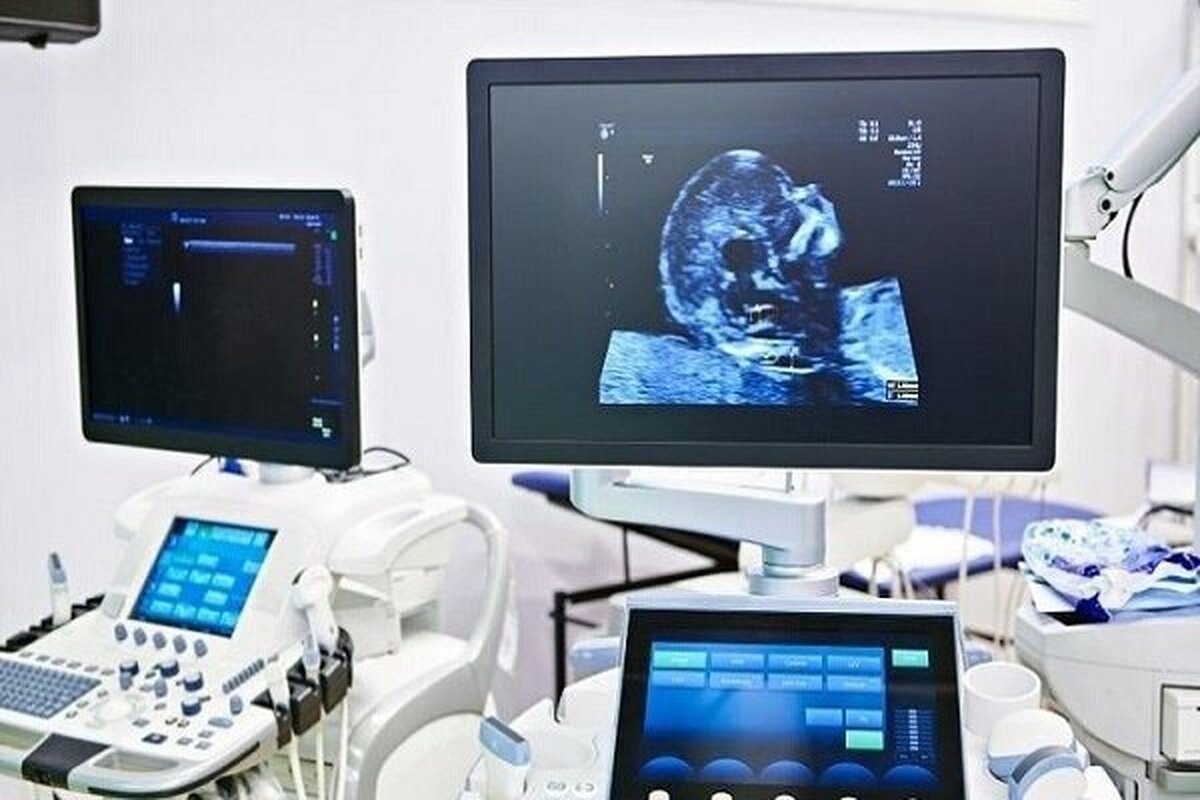 یک متخصص ژنتیک پزشکی دانشگاه علوم پزشکی رفسنجان گفت: تجمع غیرطبیعی «آمینواسید فنیل آلانین» در مایعات بدن و سیستم عصبی، باعث ابتلای نوزادان به «فنیل کتونوری» می‌شود.