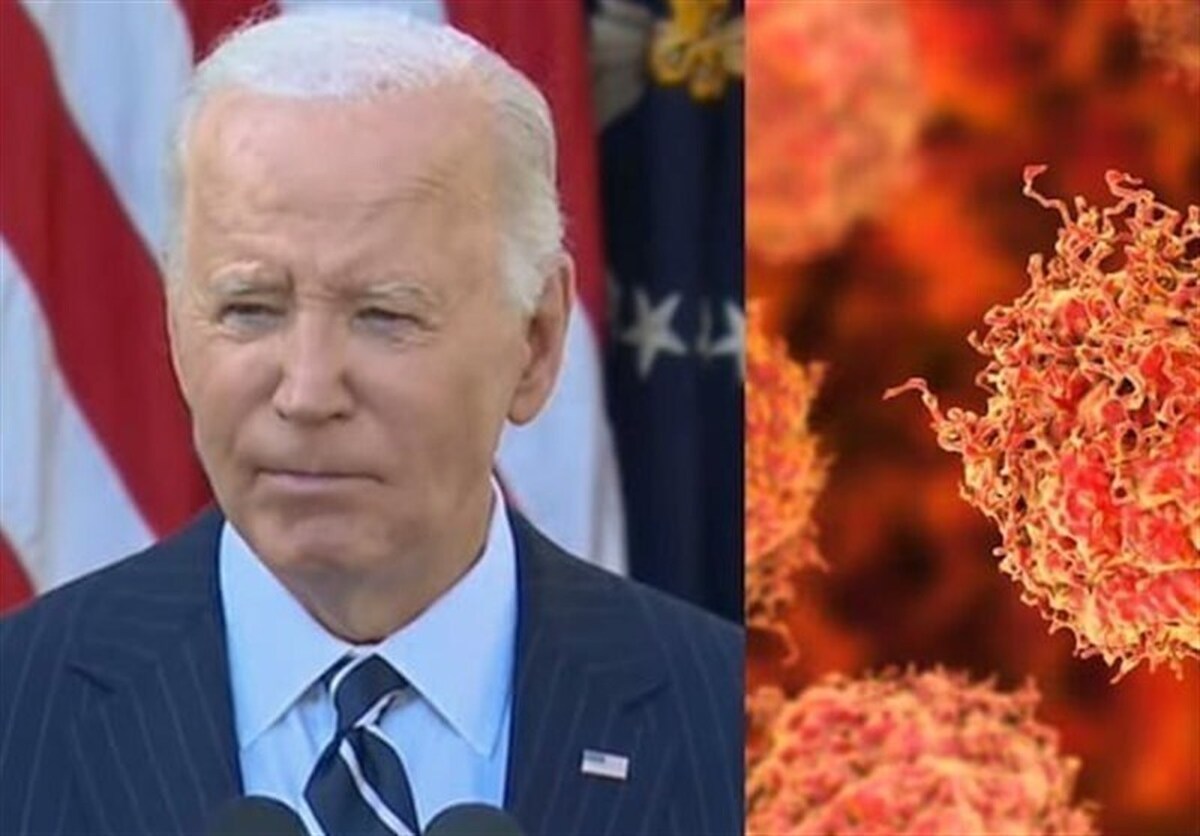 در حالی که جو بایدن در ماه‌های اخیر با سرطان پیشرفته پروستات نیز دست‌وپنجه نرم می‌کند، رسانه‌های آمریکایی از عمل جراحی تازه او برای برداشتن سلول‌های سرطانی پوست خبر داده‌اند