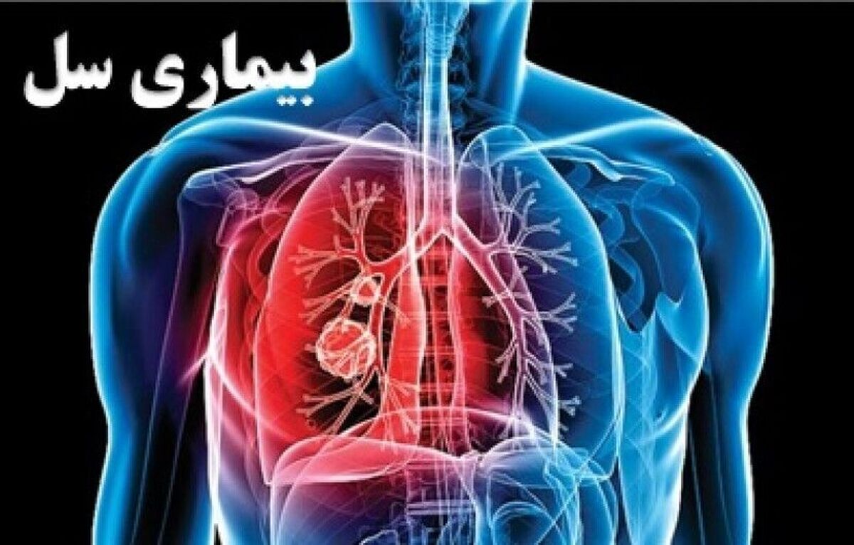 هم‌زمان با روز ملی سل، رئیس گروه پیشگیری و مبارزه با بیماری‌های واگیر معاونت بهداشت دانشگاه علوم پزشکی مشهد از آغاز پویش اطلاع‌رسانی «۱+۱ هم‌افزایی برای پایان دادن به سل» خبر داد.