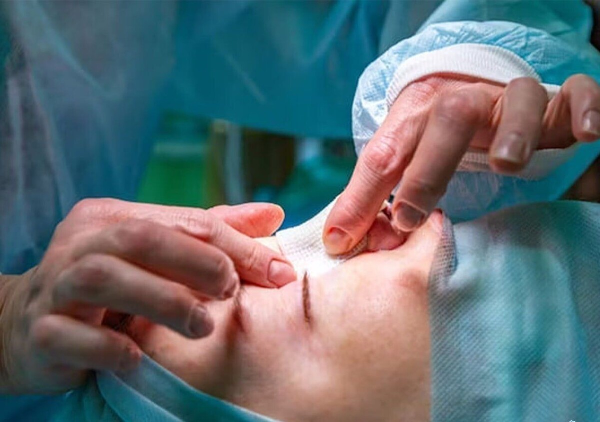 استقبال زنان از جراحی‌های زیبایی به دلیل سراب تبلیغاتی شبکه‌های اجتماعی است که شکلی غیرواقعی از ظاهر زیبا تبلیغ می‌شود.