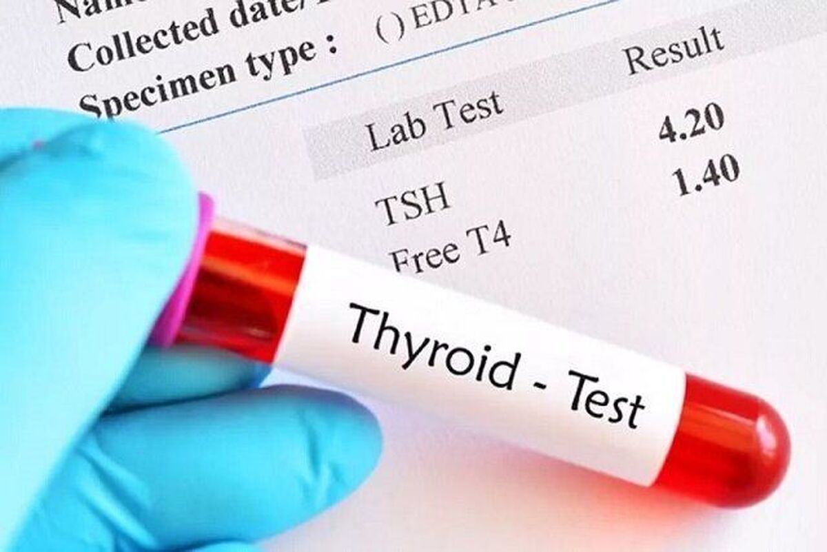 متخصص تغذیه کلینیک دیابت پژوهشگاه رویان با اشاره به اهمیت دریافت کافی ید در دوران بارداری، بر ضرورت انجام آزمایش تیروئید قبل از شروع دوران بارداری تاکید کرد.