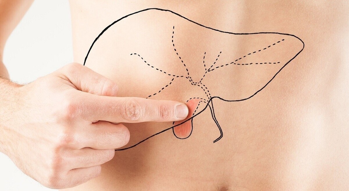 افراد ممکن است حملات مکرر کیسه صفرا را تجربه کنند. با این حال، اگر درد بیش از حد معمول ادامه پیدا کند، ممکن است ناشی از التهاب کیسه صفرا (کوله سیستیت) باشد که یک وضعیت جدی‌تر است.