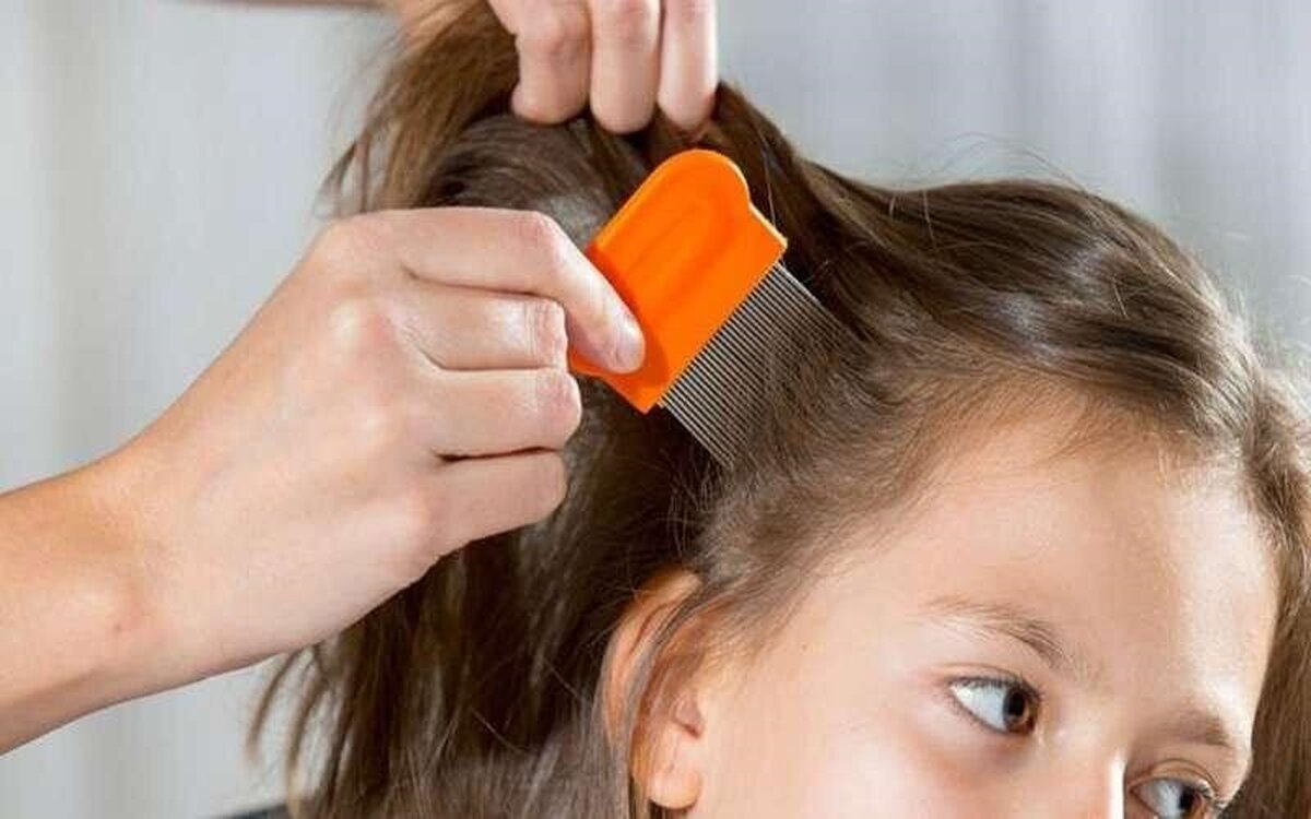 راهکار خلاصی کودک از شپش را بشناسید