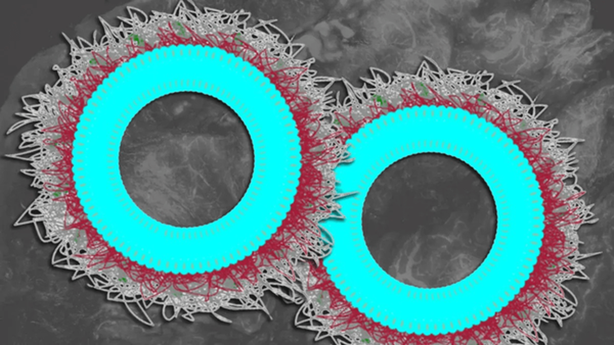 درمان سرطان تخمدان مقاوم به کمک نانو ذرات کمکی