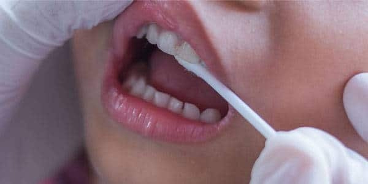 متخصص دندانپزشکی کودکان و عضو هیئت‌علمی دانشگاه علوم پزشکی شیراز تأکید کرد: اولین ویزیت دندانپزشکی کودک باید تا یک‌سالگی انجام شود.