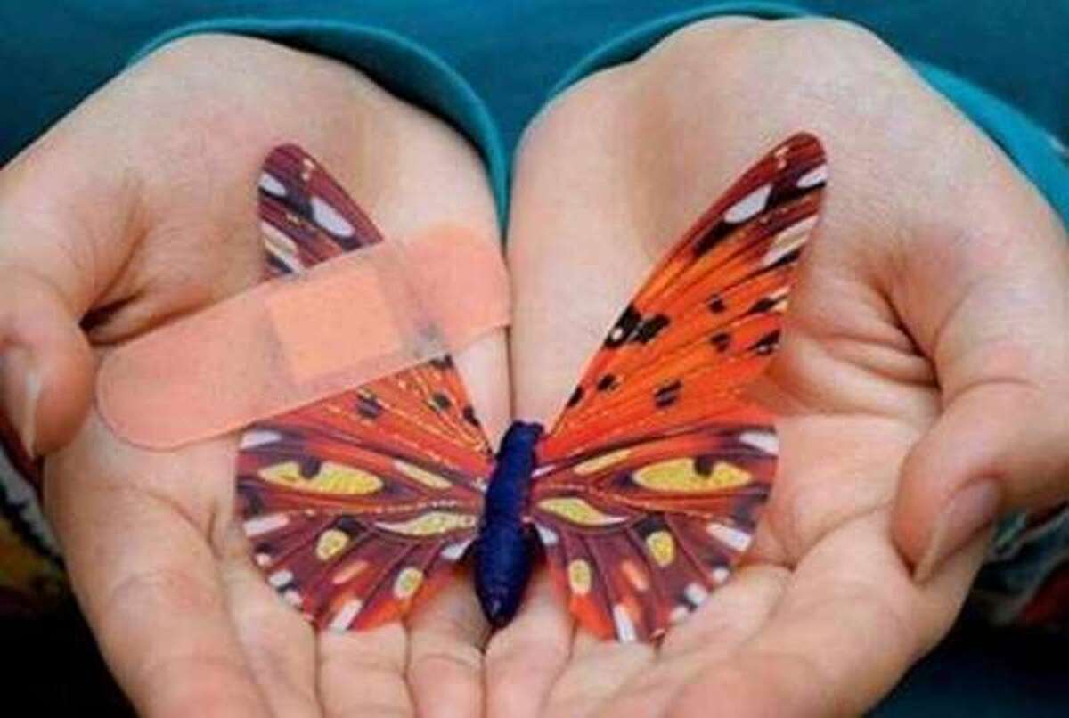 وجود هزار و ۲۵۰ بیمار پروانه‌ای در کشور