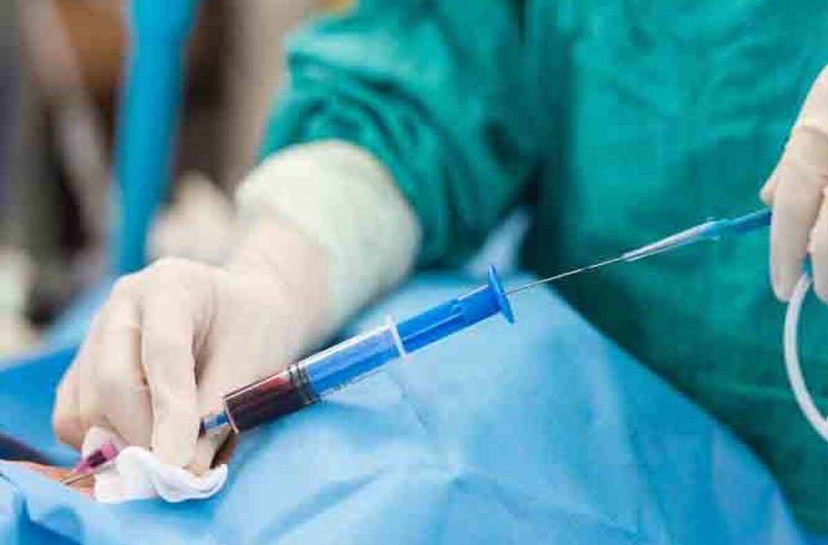 بیش از ۱۴۰۰ آنژیوگرافی در بیمارستان فارابی مشهد انجام شد