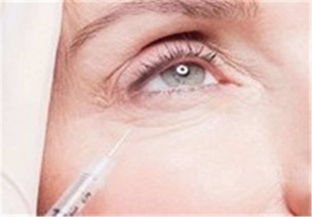 سرپرست اداره ملزومات دارویی سازمان غذا و دارو با اشاره به پرونده جنایی موسوم به «تزریق ژل‌های نامرغوب»، بر اهمیت استفاده از ژل‌ها و محلول‌های تزریقی زیبایی مورد تأیید و دارای مجوز رسمی سازمان غذا و دارو تأکید کرد.