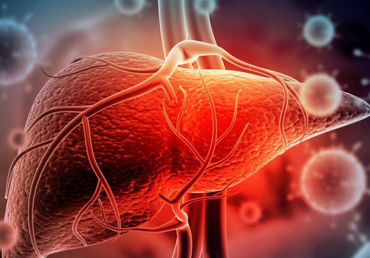 فوق تخصص گوارش، کبد و آندوسکوپی گفت: کبد چرب در اصطلاح تخصصی به معنی تجمع واکوئل‌های چربی در سلول‌های کبدی است. اگر این تجمع در بدن از حد معمول خود بگذرد، باعث حمله گلبول‌های سفید به سلول‌های سرشار از چربی شده و این موجب ایجاد التهاب می‌شود. این التهاب به مرور منجر به سیروز و سیروز پیشرفته یا همان نارسایی کبدی می‌شود.