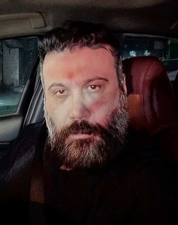 چهره شکسته «محسن چاوشی» + عکس چهره شکسته «محسن چاوشی» + عکس