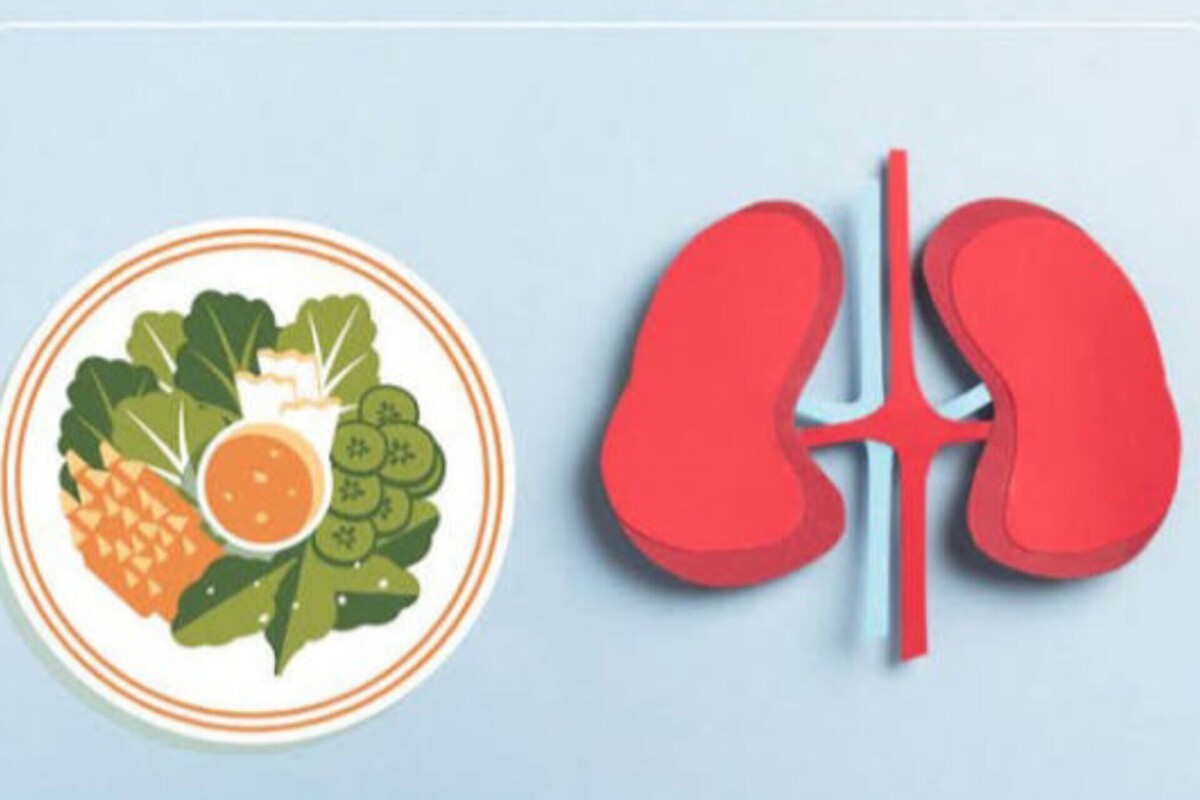 چگونه با اصلاح سبک زندگی از سنگ کلیه در امان بمانیم؟