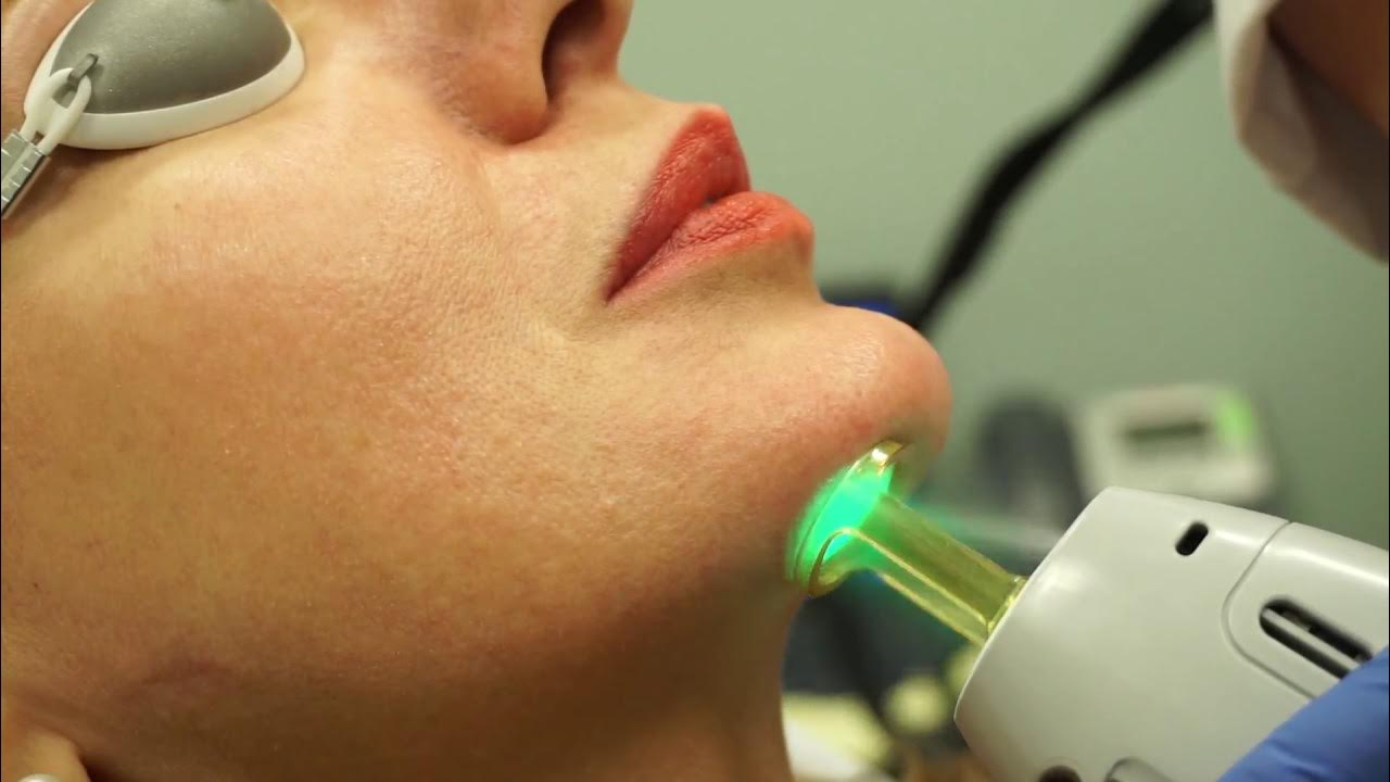 لیزر برای از بین بردن جای بخیه