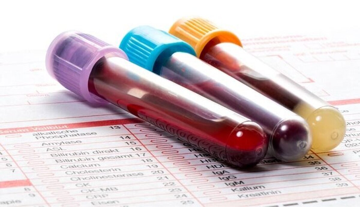 مدیر انجمن تالاسمی خوزستان: حذف ارز ترجیحی دارو منجر به مرگ تدریجی بیماران تالاسمی می‌شود