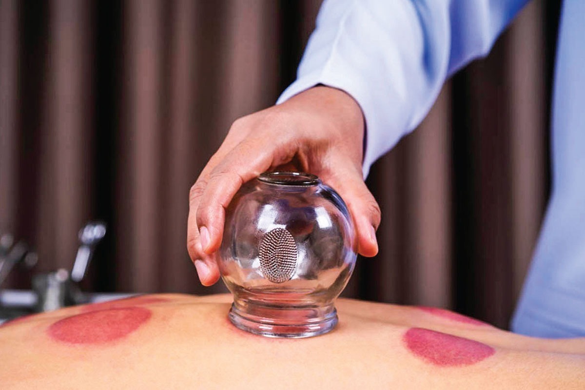 حجامت توسط افراد غیر متخصص خطرناک است