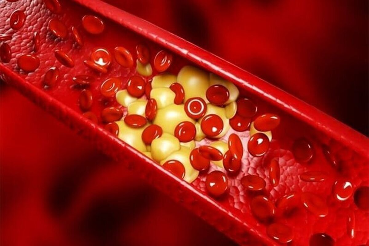 قرص چربی خون را چه زمان و چطور مصرف کنیم؟