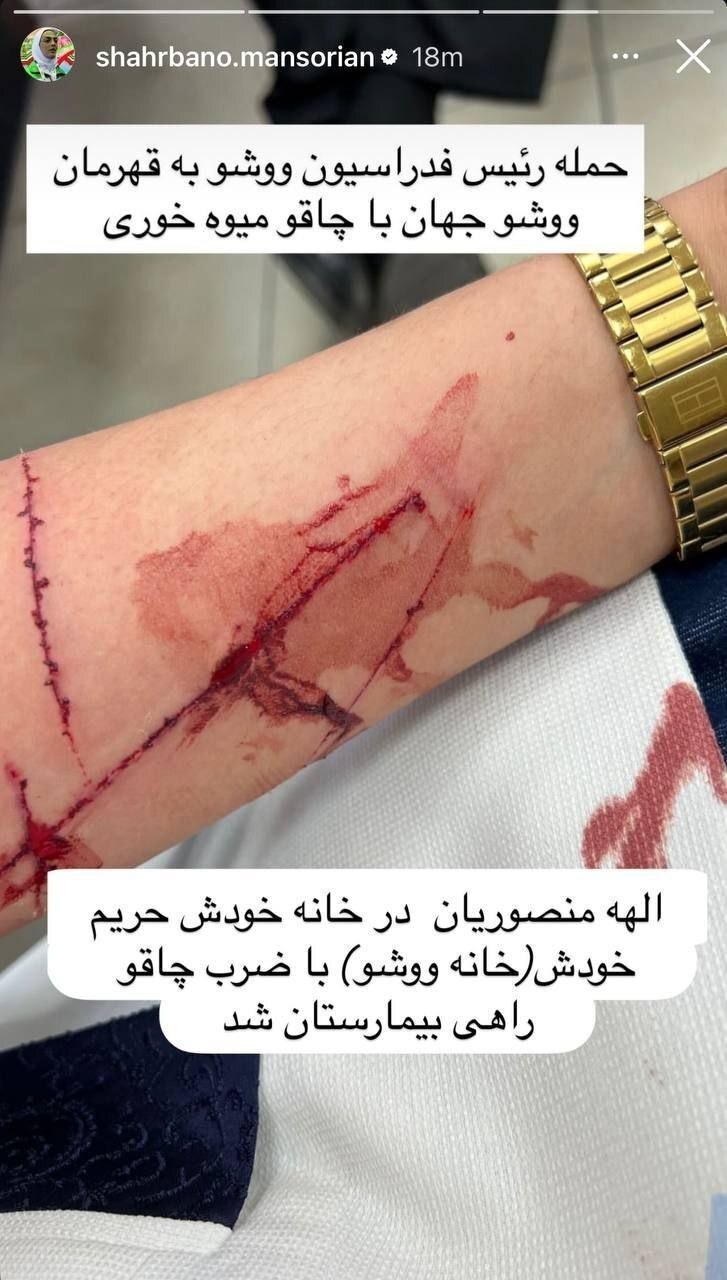 اتهام سنگین منصوریان علیه رئیس ووشو | فدراسیون: برای فضاسازی خودزنی کردند! + عکس