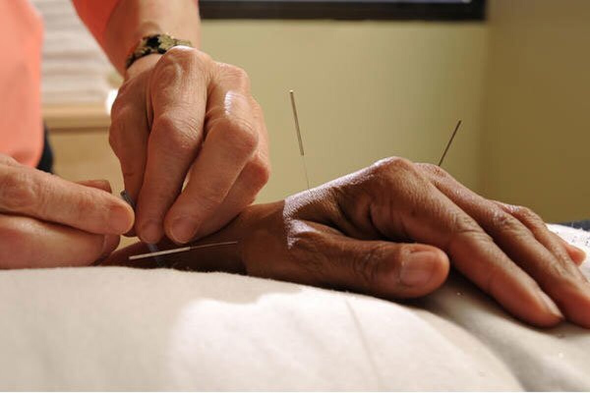 آیا طب سوزنی در کاهش درد سیاتیک موثر است؟