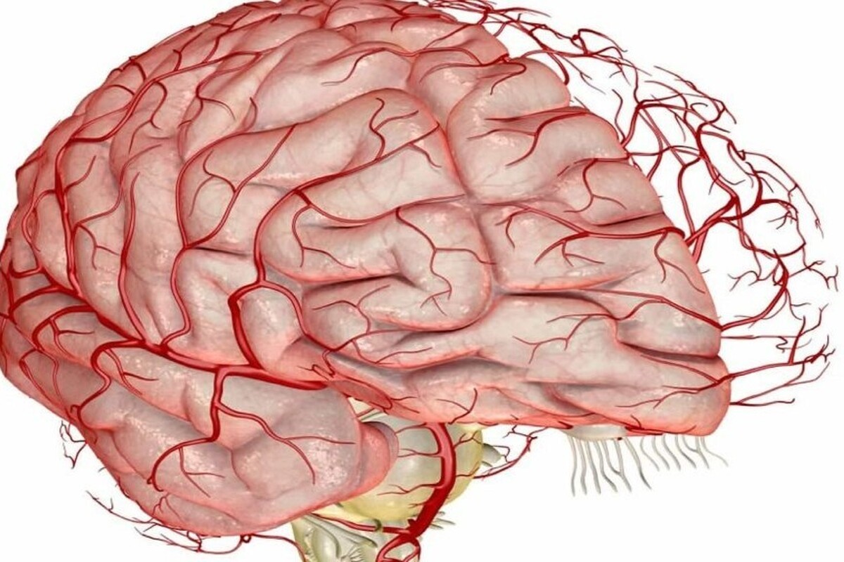 هوش مصنوعی خطر سکته مغزی را از روی عادت‌های روزانه سالمندان تشخیص می‌دهد