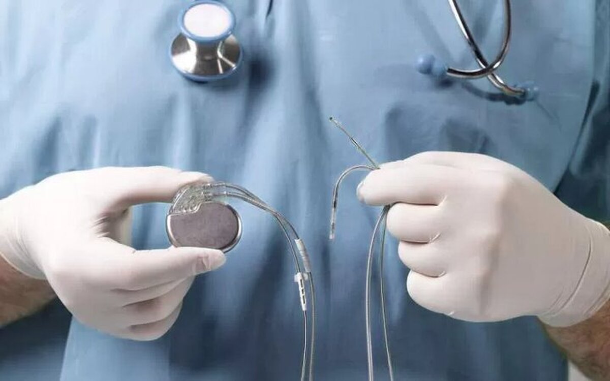 پایان صف انتظار باتری&zwnj;های قلبی و ICD | تأمین تجهیزات برای ۱۲ هزار بیمار