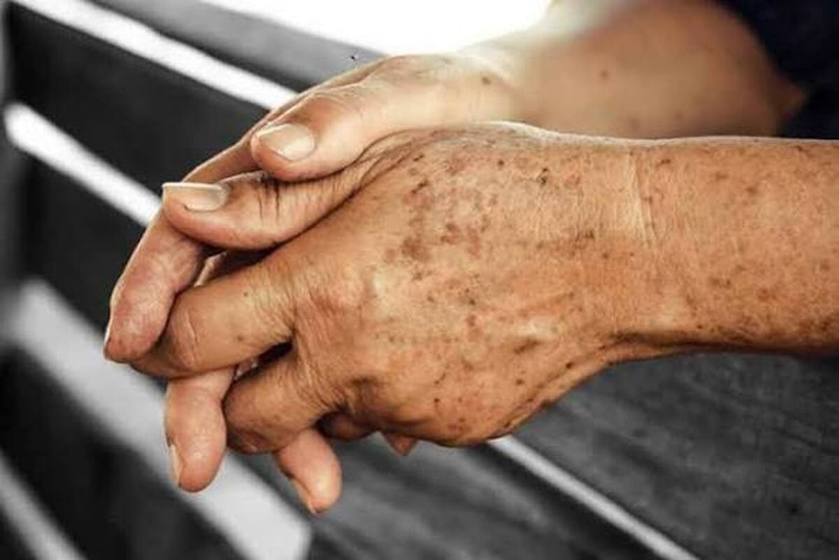 اینفوگرافی| سپر دفاعی در برابر لکه&zwnj;های پیری