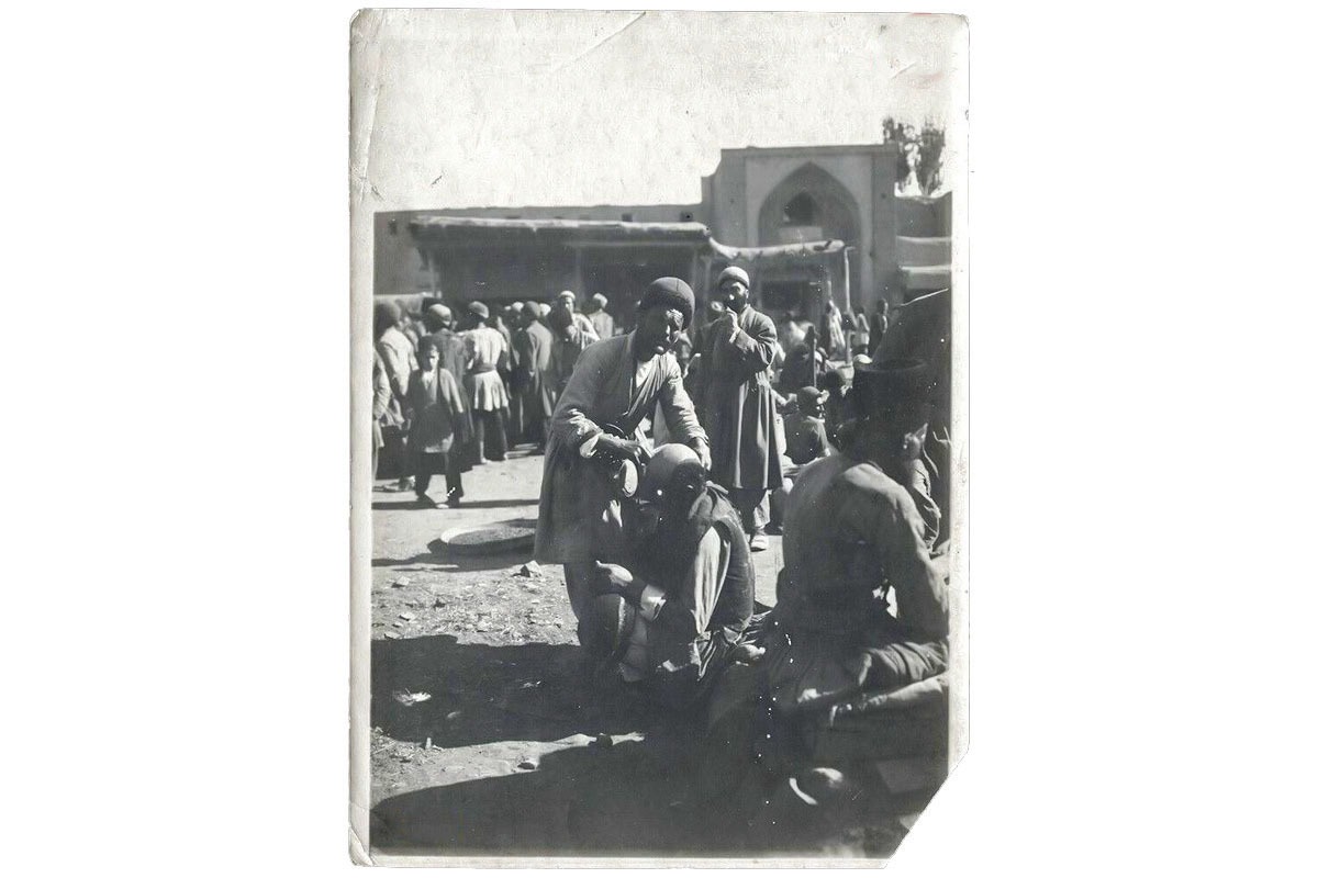 وقتی «کچلی» غصه بزرگ مشهدیها بود | روایت مبارزه ۷۰ساله با یک بیماری وقتی «کچلی» غصه بزرگ مشهدیها بود | روایت مبارزه ۷۰ساله با یک بیماری