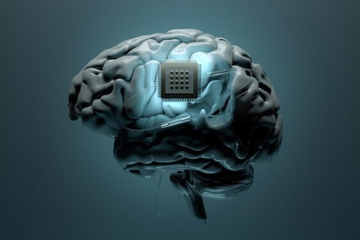 رابط مغز و رایانه چینی در ۱۰ دقیقه کاشته می‌شود؛ سریع‌تر از جراحی نورالینک