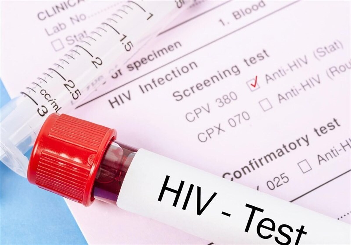 انجام ۳۲ هزار تست HIV در جمعیت‌های در معرض خطر و زندان‌های زیر پوشش دانشگاه علوم پزشکی مشهد